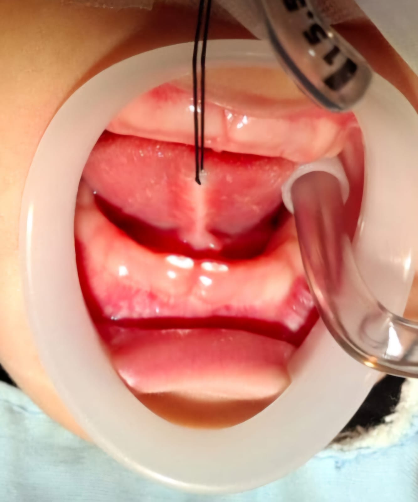 Imagen del artículo