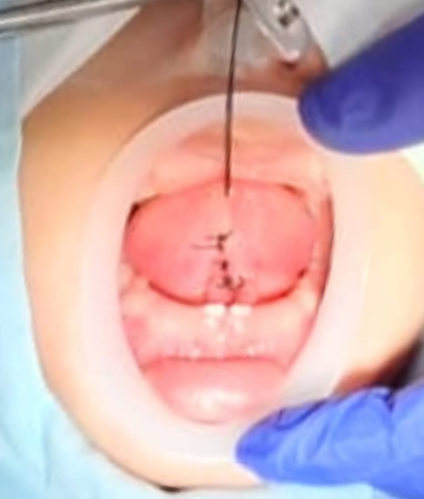 Imagen del artículo