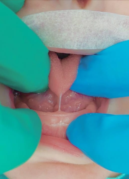 Imagen del artículo