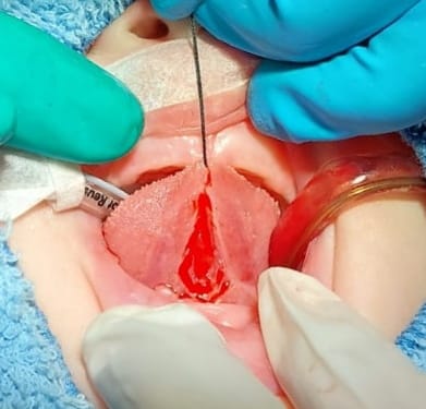 Imagen del artículo