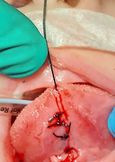 Imagen del artículo